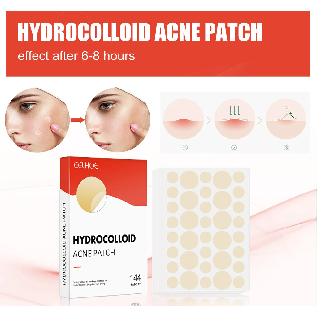Liveify hydrocolloid acne patch in clear round design, 144-count box with before-after skin effect shown