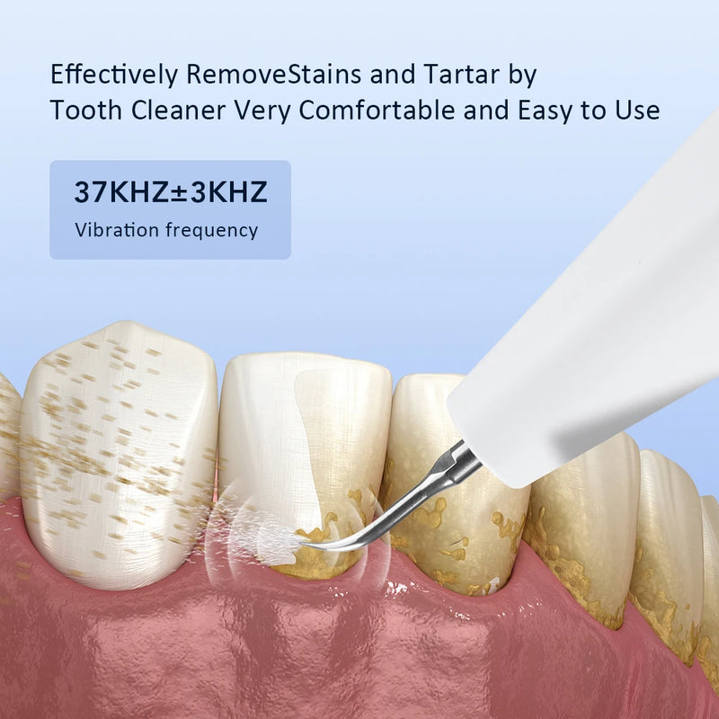 Liveify Electric Ultrasonic Teeth Cleaner – Portable Dental Scaler for Plaque, Tartar & Stain Removal, Deep Cleaning Oral Care Tool (Rechargeable, Home Use)