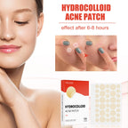 Liveify hydrocolloid acne patch pack with 144 clear circular patches for fast blemish healing, shown on skin before and after use