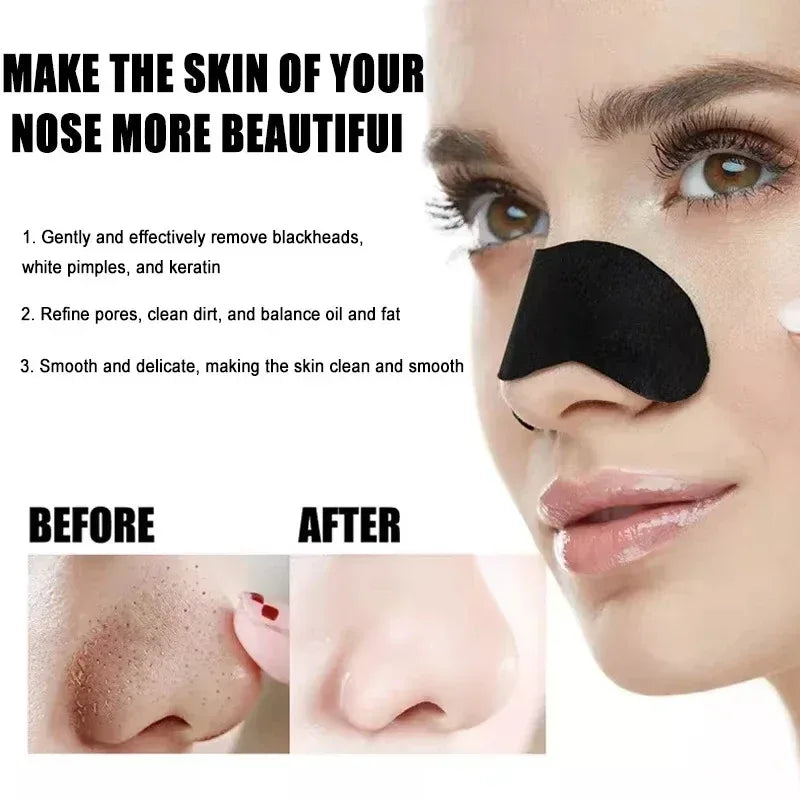 Blackhead Removal Nose Strips - liveify