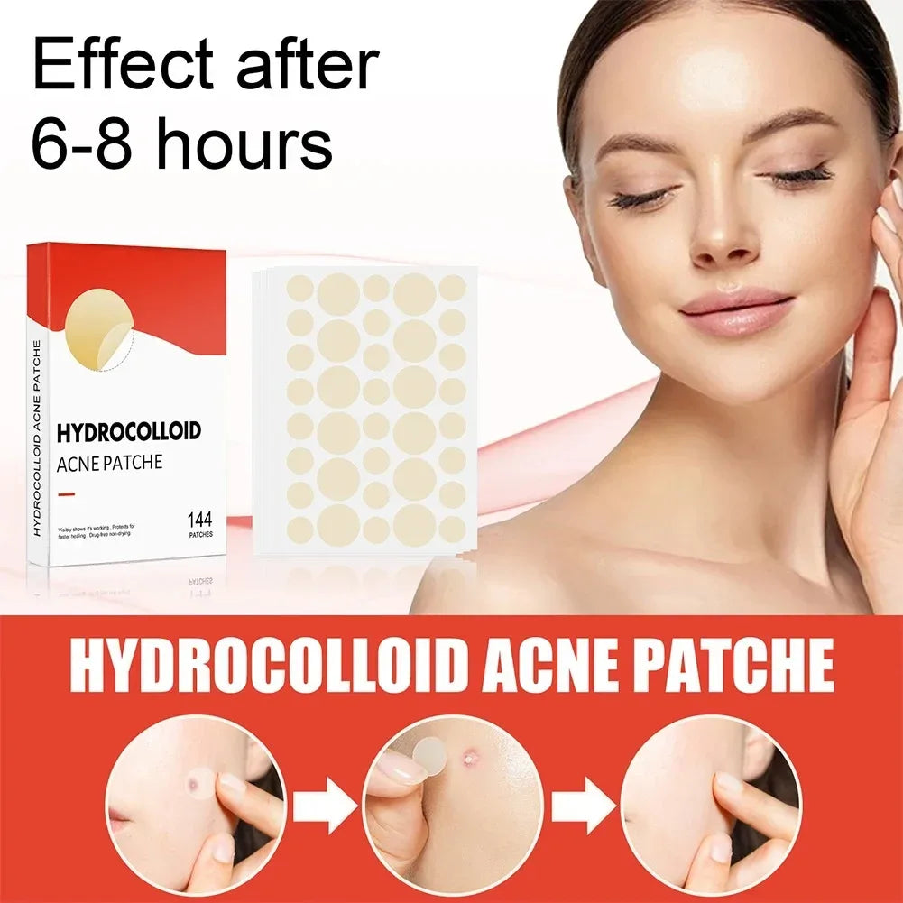 144pcs Hydrocolloid Pimple Patch - liveify