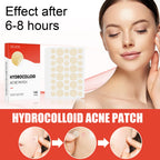 Liveify hydrocolloid acne patch for clear skin, 144 patches, visible healing effect after 6-8 hours