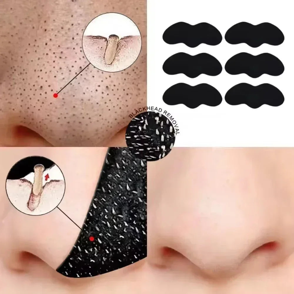 Blackhead Removal Nose Strips - liveify