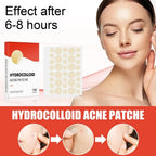 Skin Care Pimple Acne Patches - liveify
