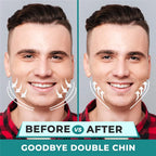 Liveify before vs after double chin reduction, showcasing jawline tightening with arrows on smiling man in plaid shirt
