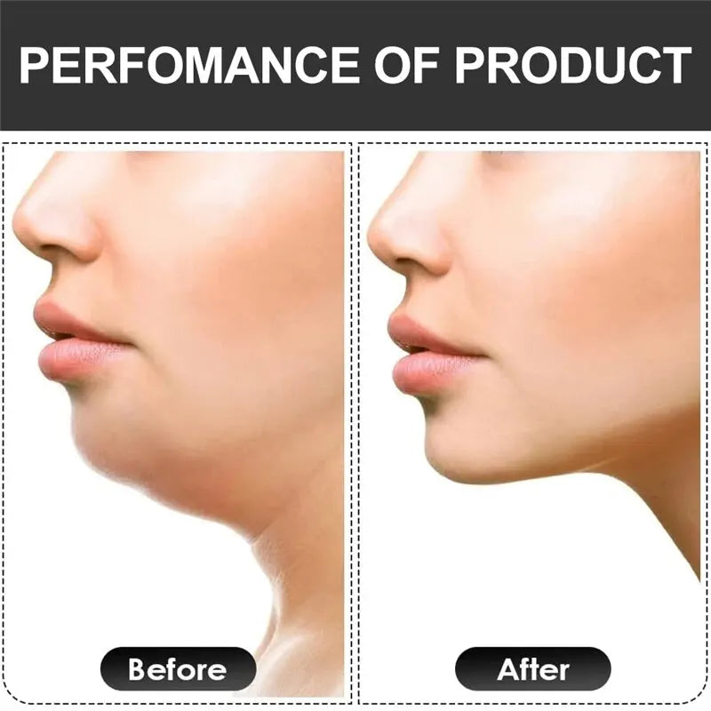 Liveify before and after showing improved jawline definition with smoother skin tone