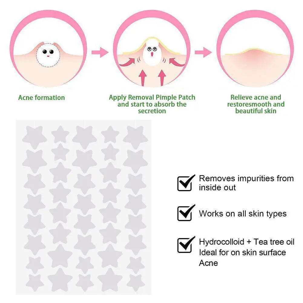 Liveify star-shaped acne pimple patches, hydrocolloid with tea tree oil, removes impurities, works on all skin types