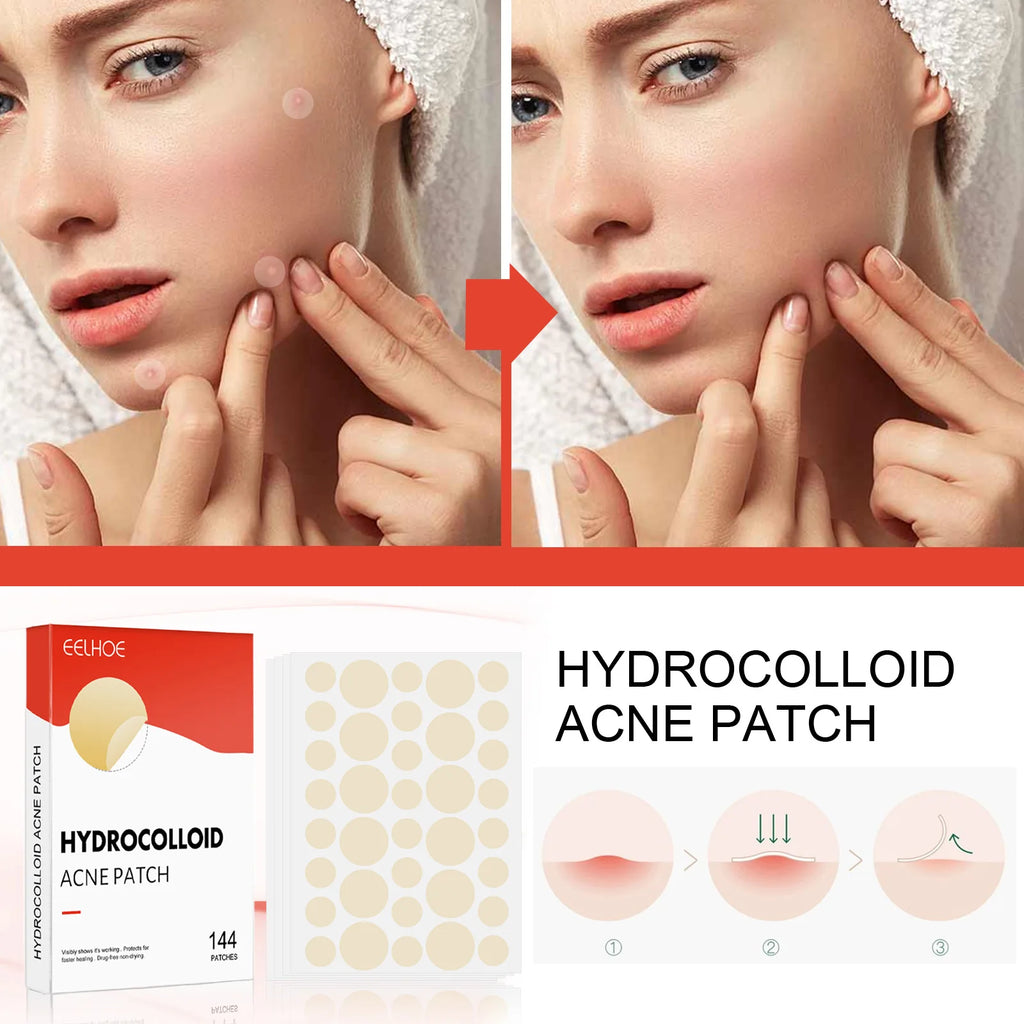 Liveify hydrocolloid acne patch for clear skin, shown with before-and-after results and 144 patches in box